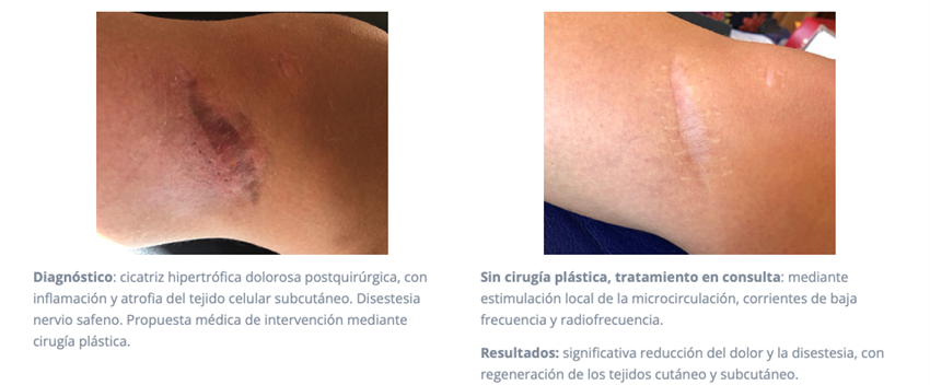Terapia Dermato Funcional